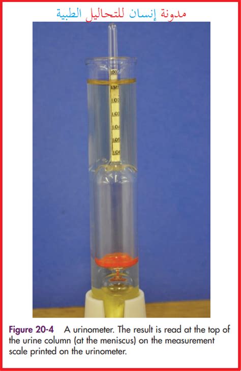 refractometer vs urinometer|refractometer for urine specific gravity.